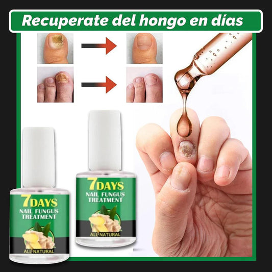 💅 (COMPRA 1 & LLEVA2) ✨ Serum endurecedor 7 DÍAS - Uñas largas y fuertes + ENVIO GRATIS - Uno Mundo de Opciones